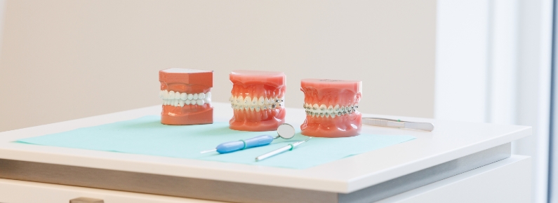 Orthodontie behandeling - Tandzorg Twente